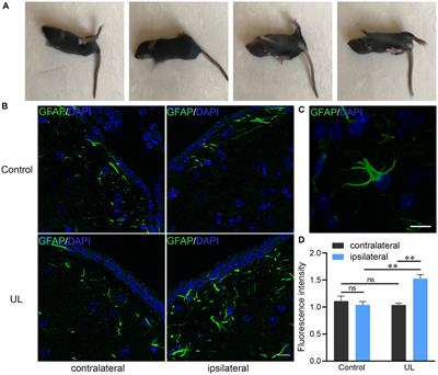 Redistribution of the astrocyte phenotypes in the medial vestibular nuclei after unilateral labyrinthectomy